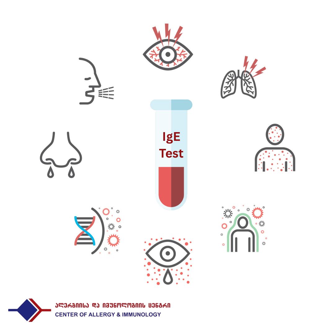 IgE - ანტისხეულები