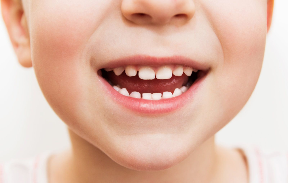 ბავშვებში კბილის ამოსვლის შეფერხება