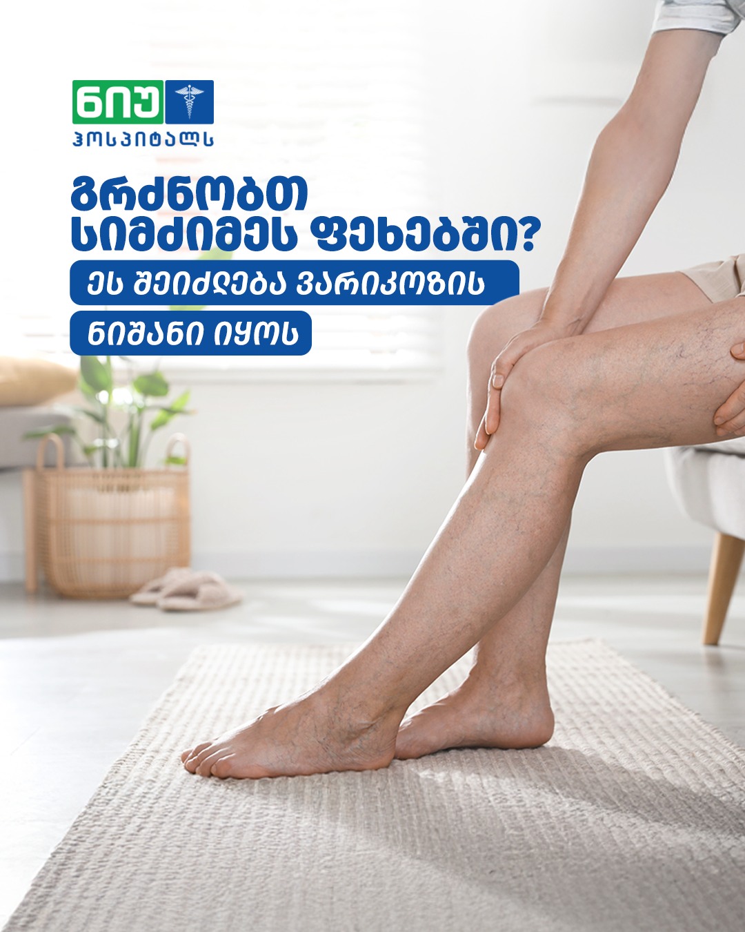 ვარიკოზული და ობობისებური ვენები