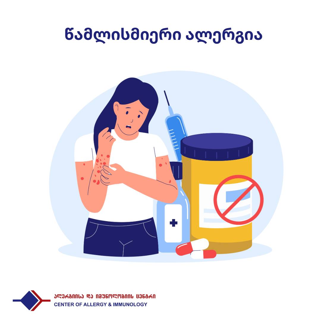 წამლისმიერი ალერგია