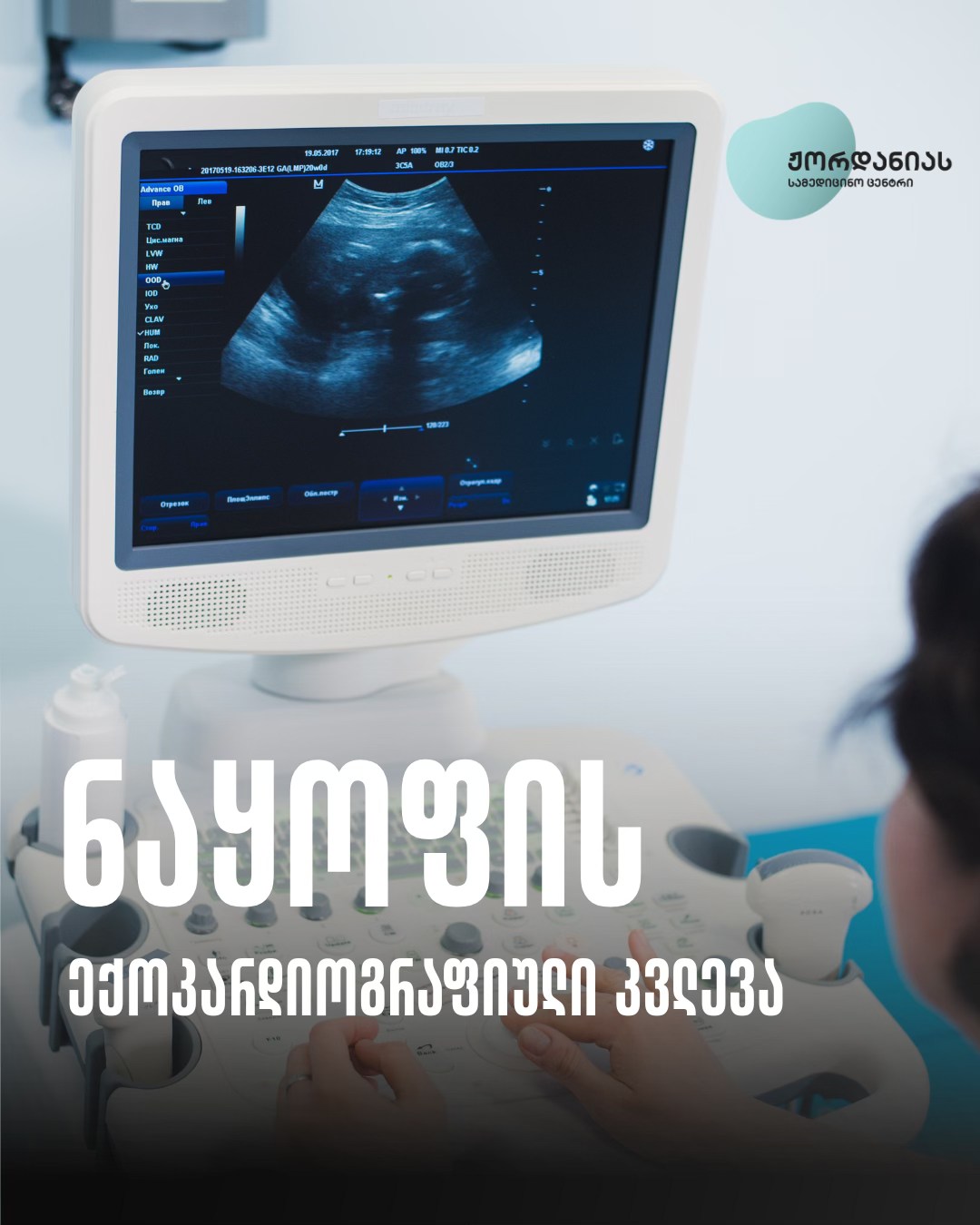 ნაყოფის ექოკარდიოგრაფიული კვლევა