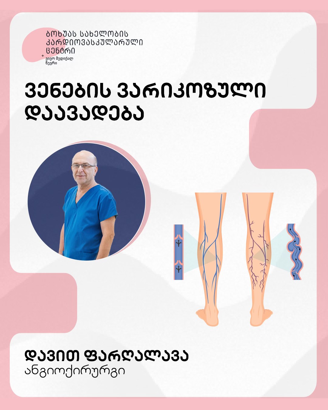 ვენების ვარიკოზული დაავადება